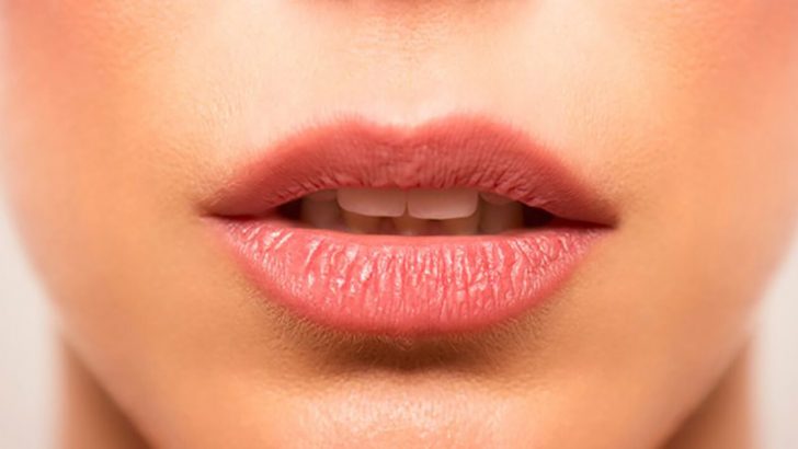 Cara Mengatasi Bibir Pecah-Pecah dengan Cepat dan Alami